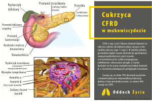 Cukrzyca w mukowiscydozie CFRD