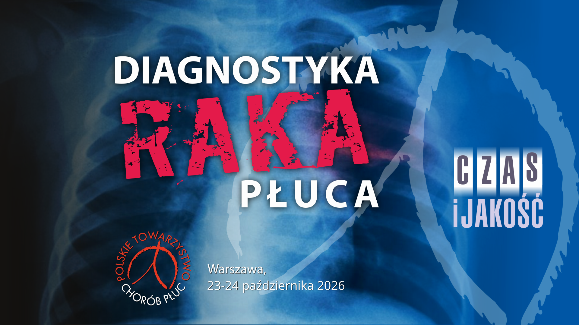 Diagnostyka raka płuc